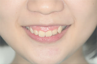 術前診査診断１