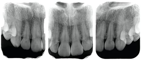 術前診査診断３
